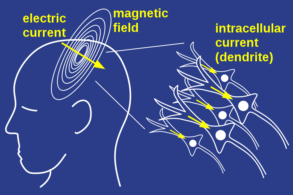 Neuroni stvaraju elektromagnetske valove. Izvor: Wikimedia Commons